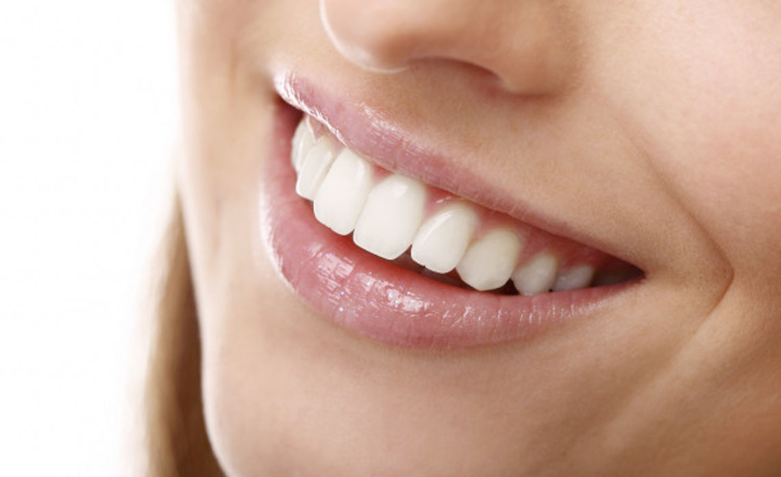 10 preguntas sobre Blanqueamiento dental